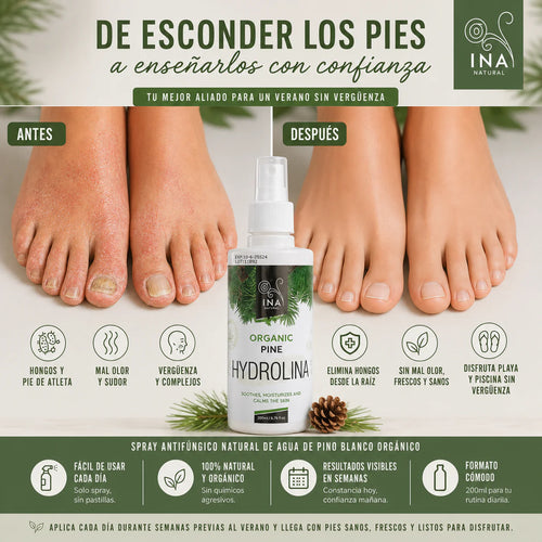 Spray de Hydrolina · Elimina Hongos en Uñas y Pies